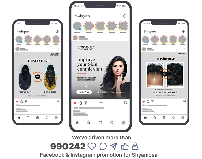 Social Media Marketing for Skin Care Clinic in Surat